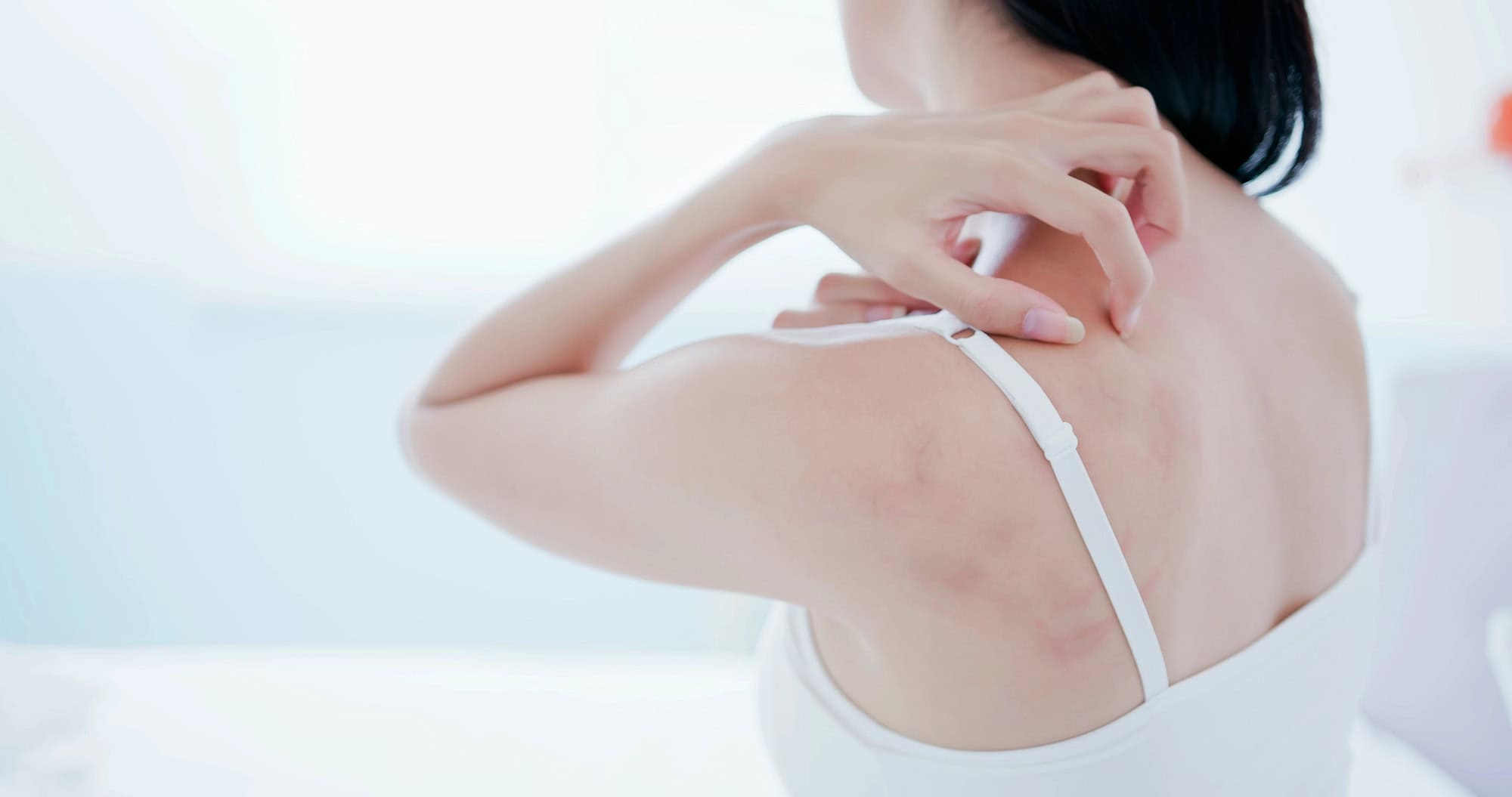 Tanning Lotion Rash Tanning Bed Rash On Buttocks (How To Treat It And Prevent It) - Good ...